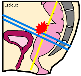 anatomie du rectum