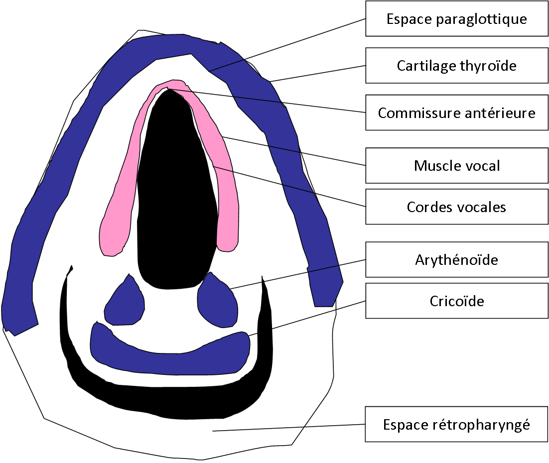 Pharyngo larynx