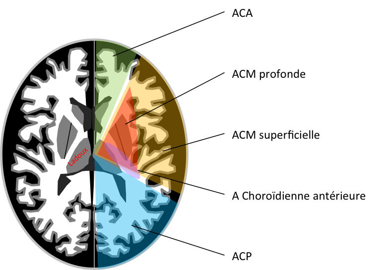 AVC - territoires vasculaires