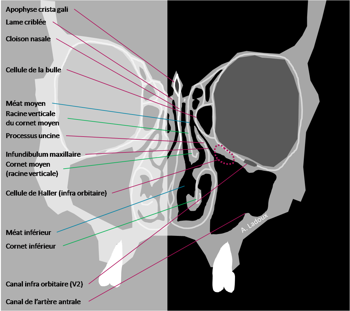 Anatomie coronale des sinus