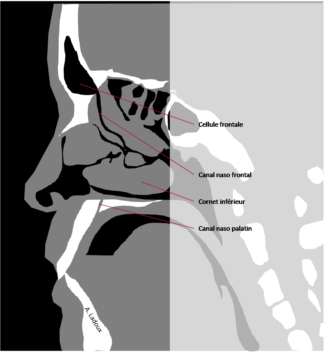Anatomie sagittale des sinus