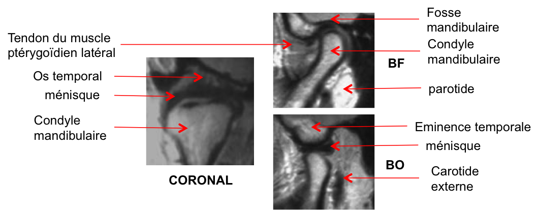 imagerie atm. aide diagn. troubles cranio-mandibu.