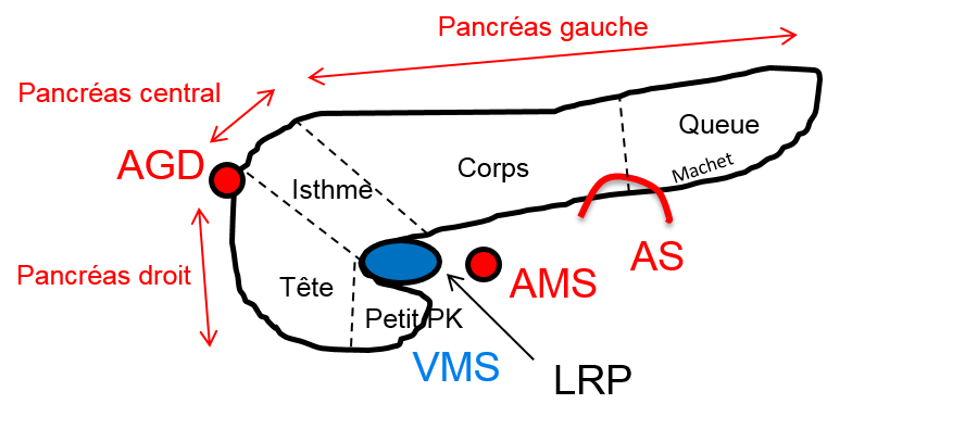 Tumeur pancréas