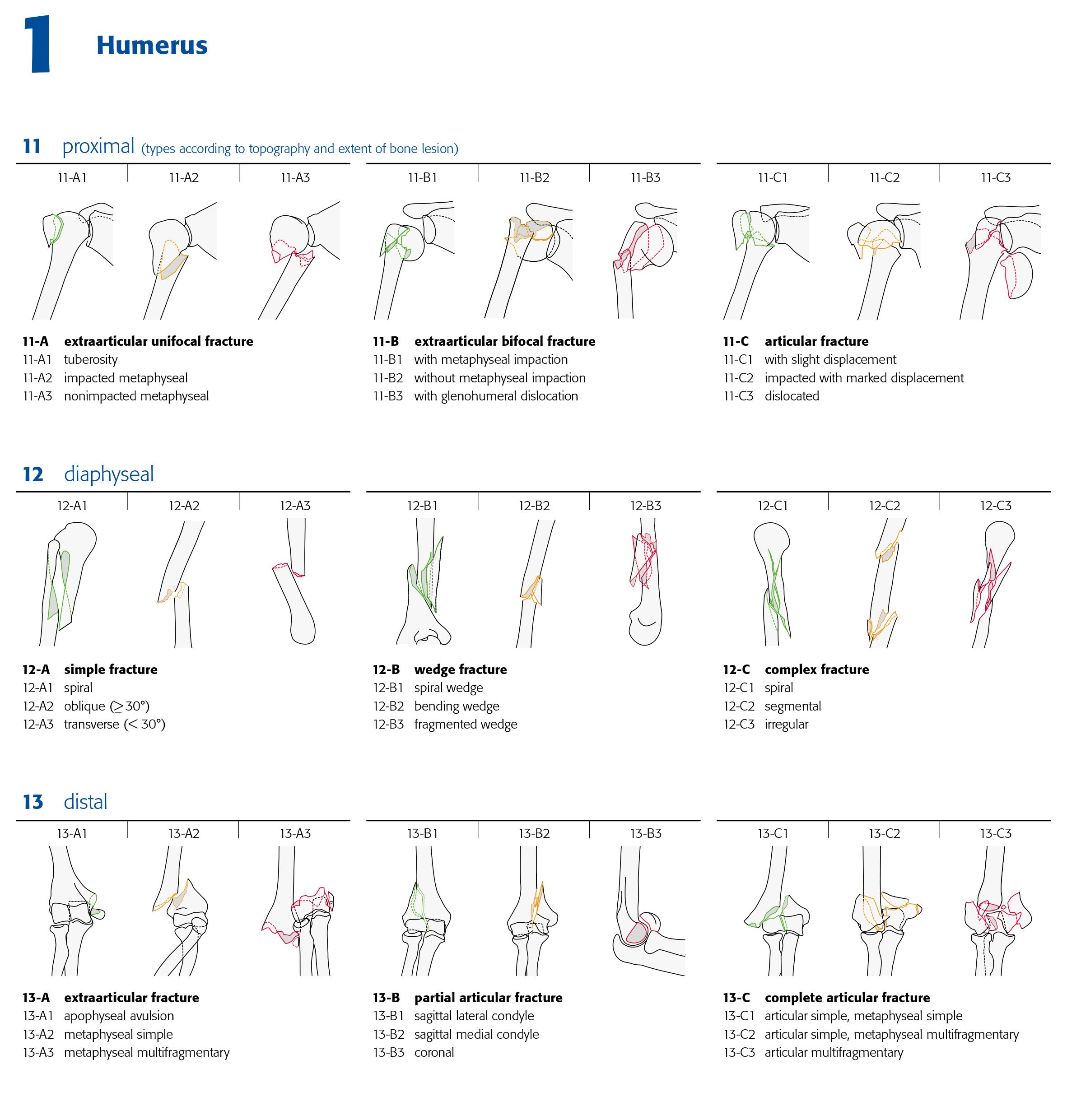 AO Classification