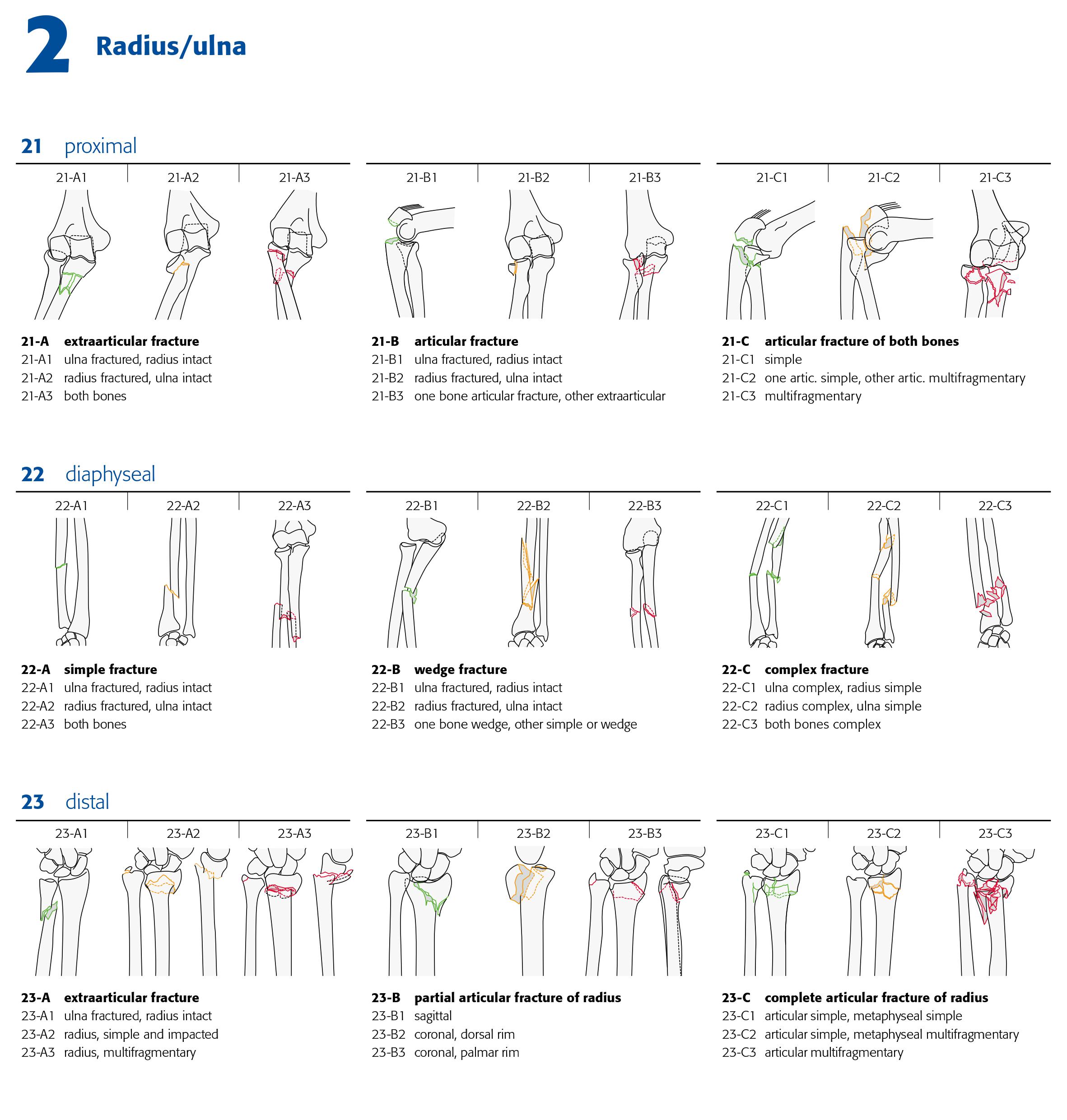 AO Classification