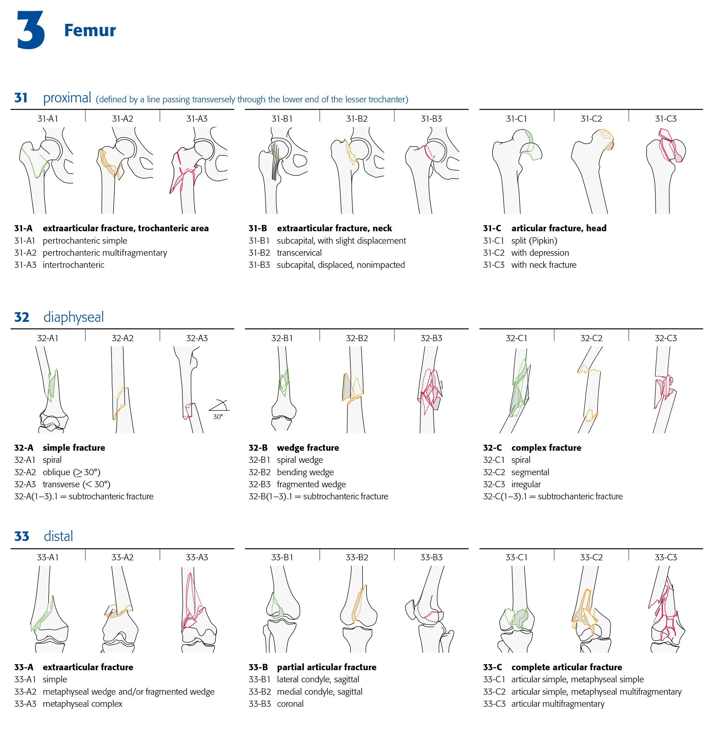 AO Classification