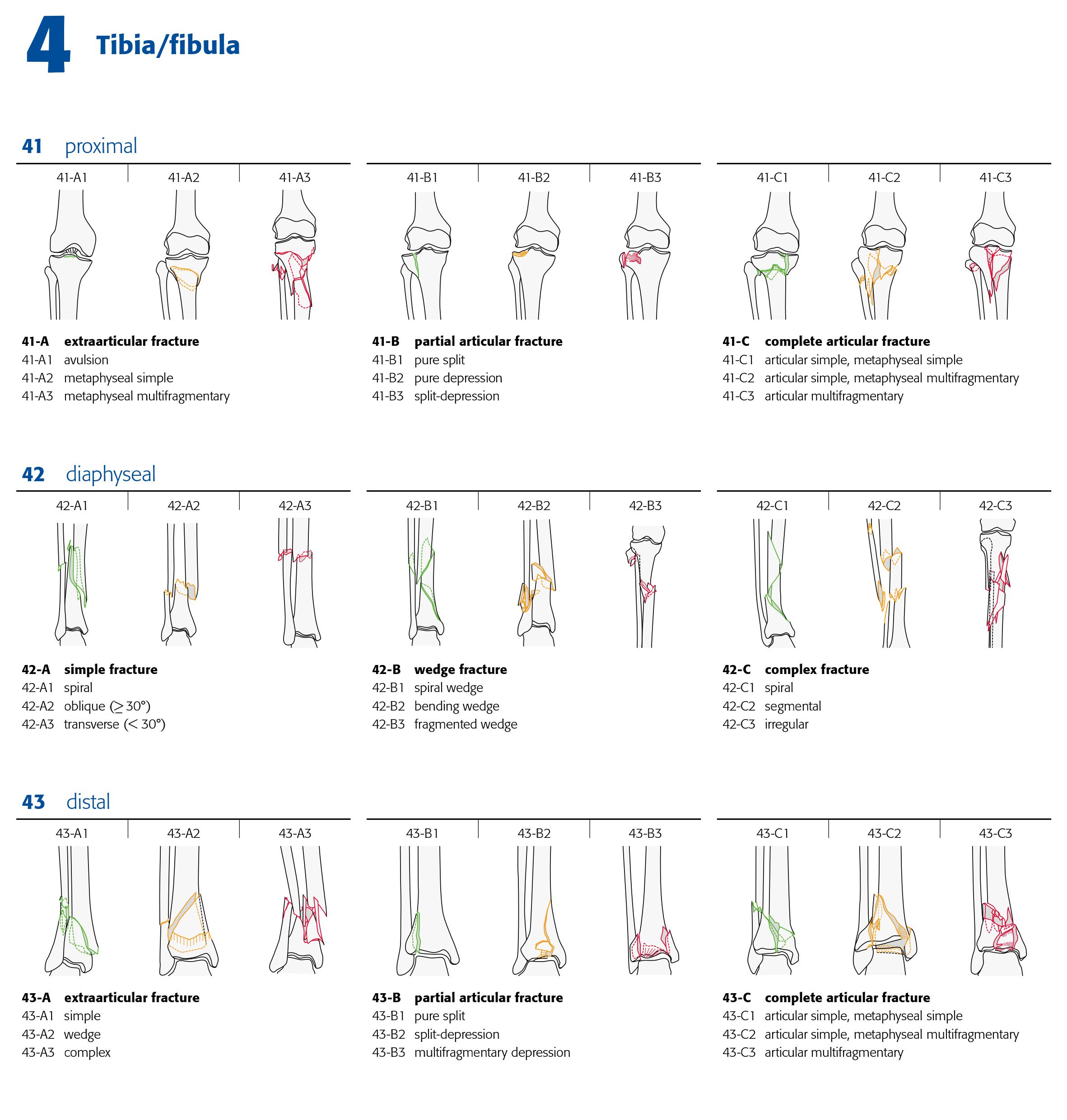 AO Classification