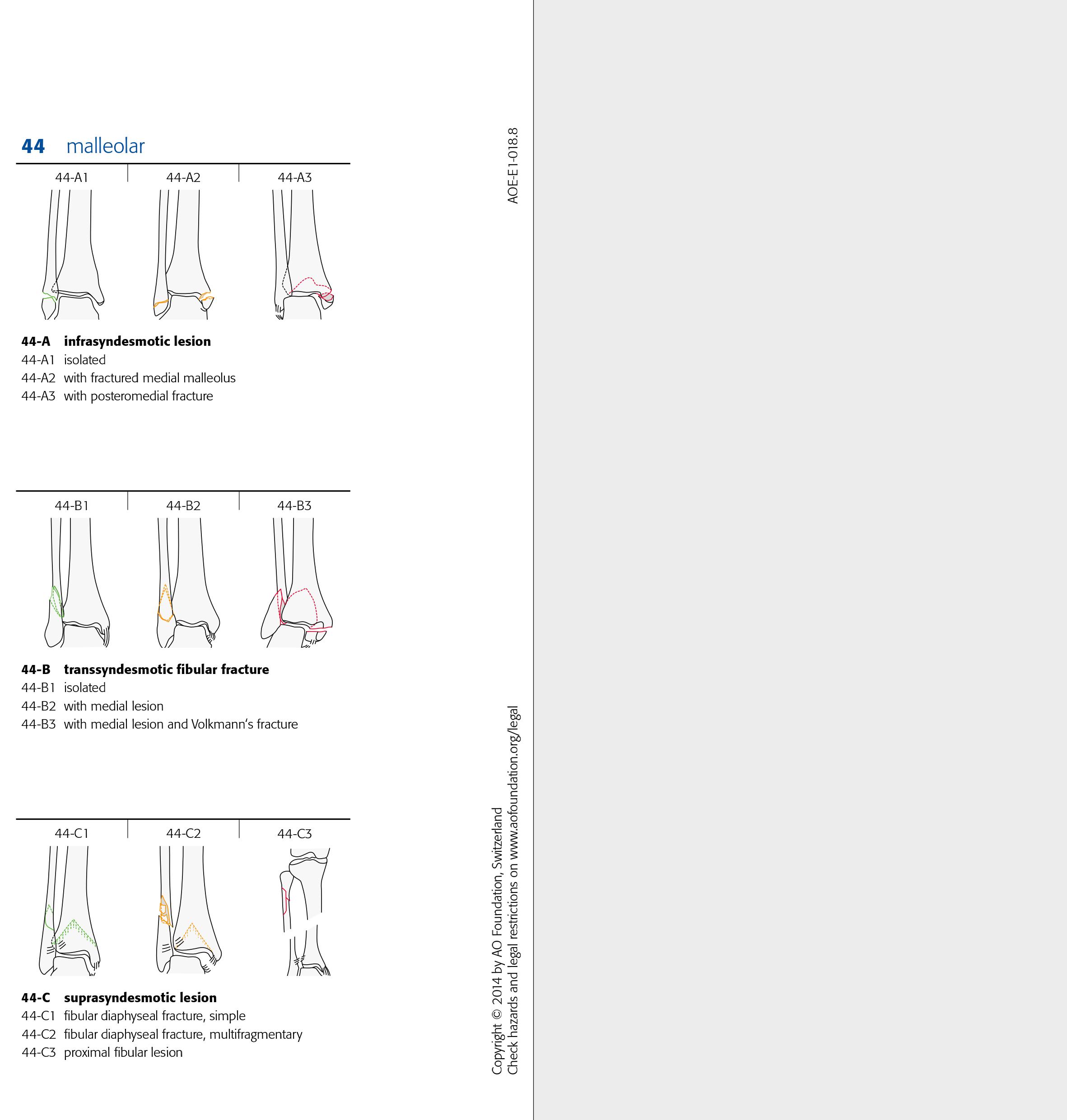 AO Classification