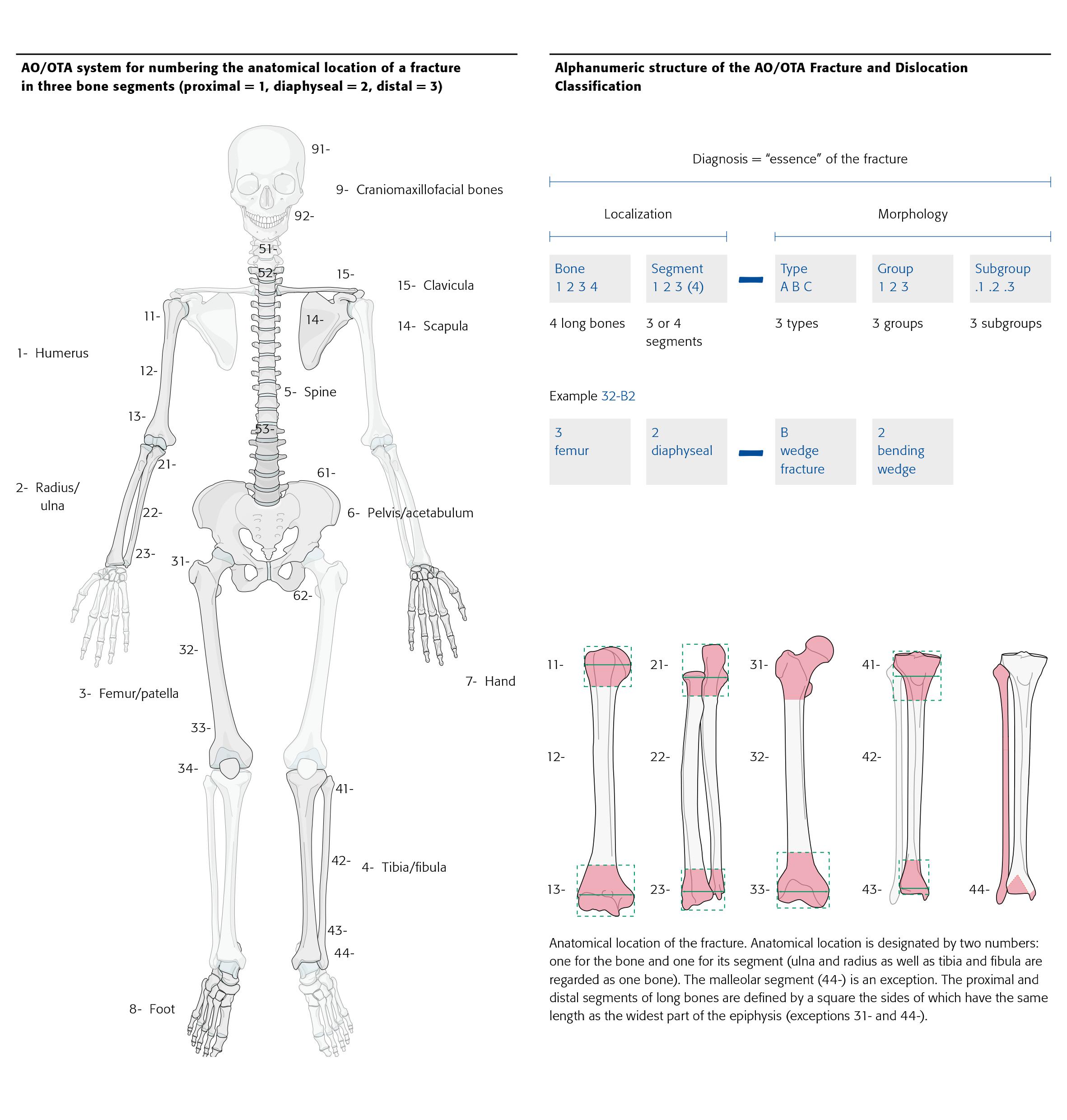 AO Classification