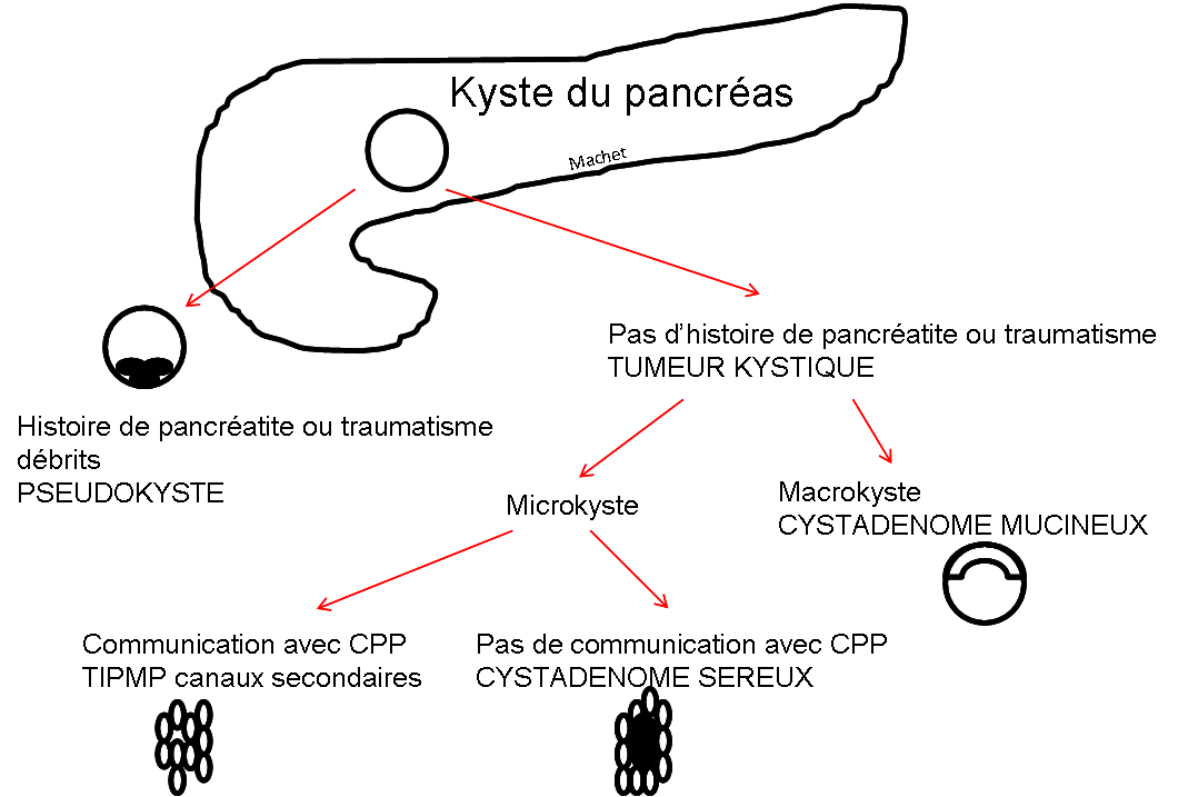 kystes pancreas 2