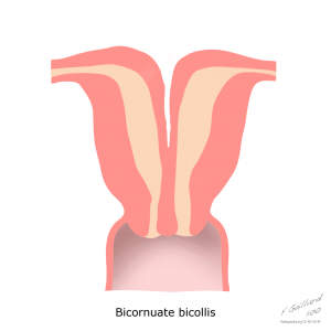 uterine-anatomical-abnormalities (1)