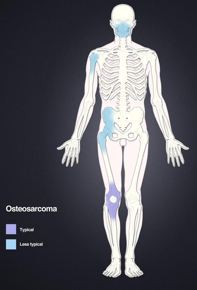 Anatomie Humaine De Vésicule Biliaire Et De Pancréas Illustration Stock -  Illustration du diagnostique, biologie: 74088490