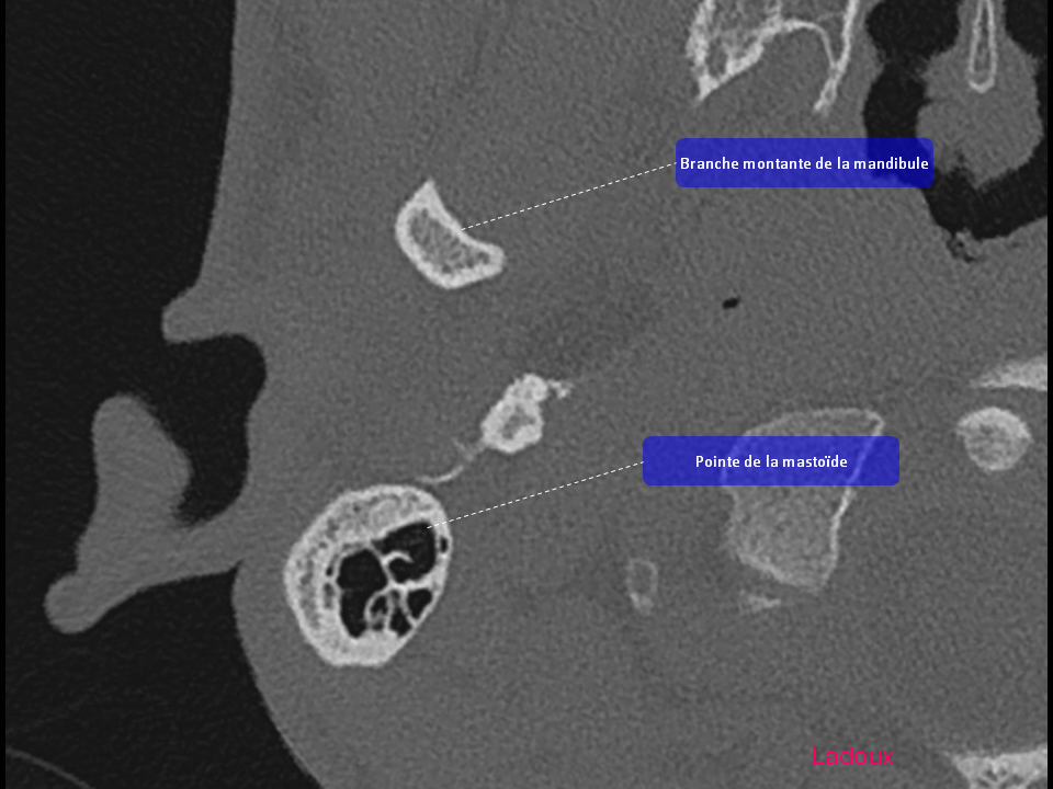 Anatomie du rocher