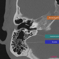 Anatomie du rocher