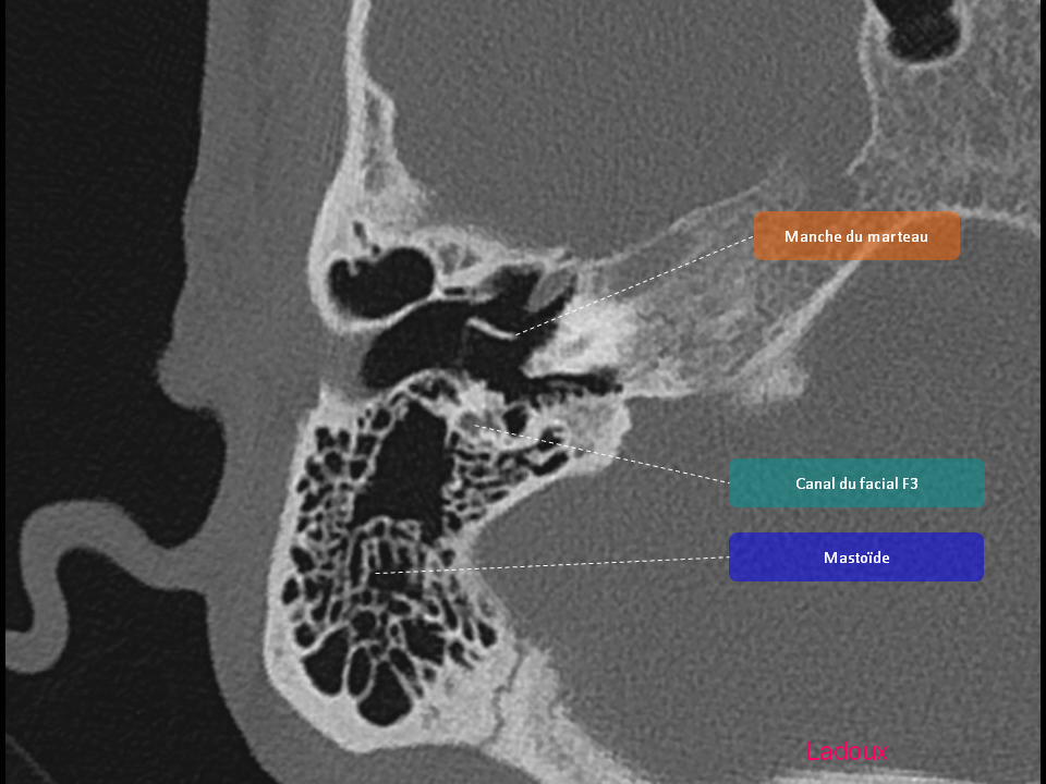 Anatomie du rocher