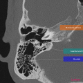 Anatomie du rocher