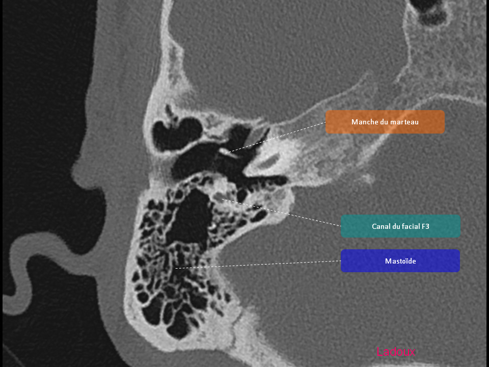 Anatomie du rocher