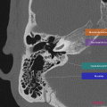 Anatomie du rocher