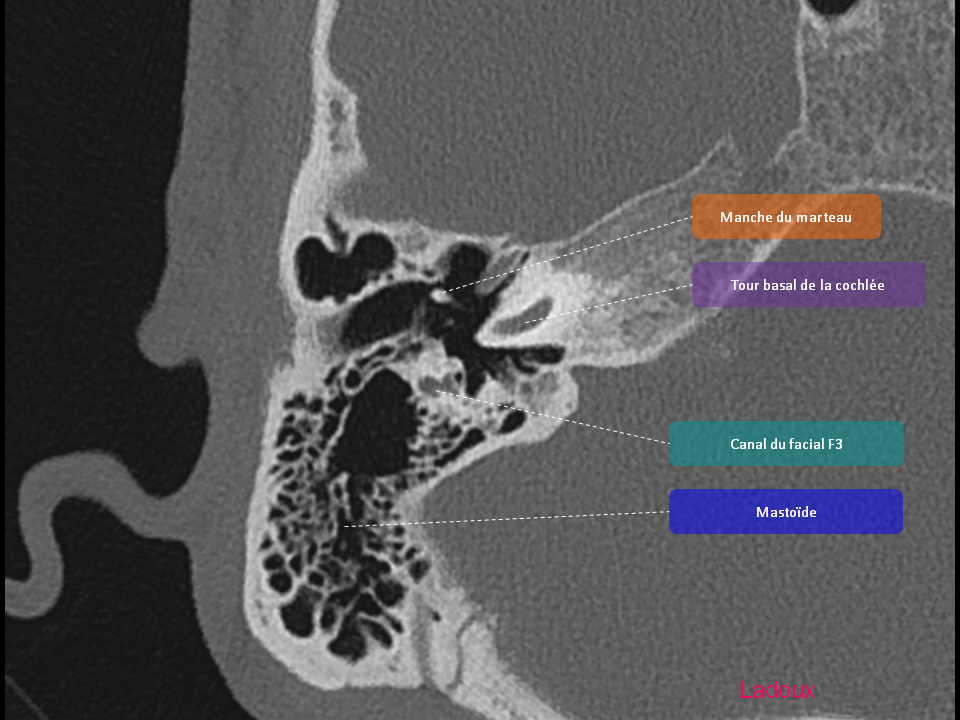 Anatomie du rocher