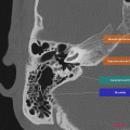 Anatomie du rocher