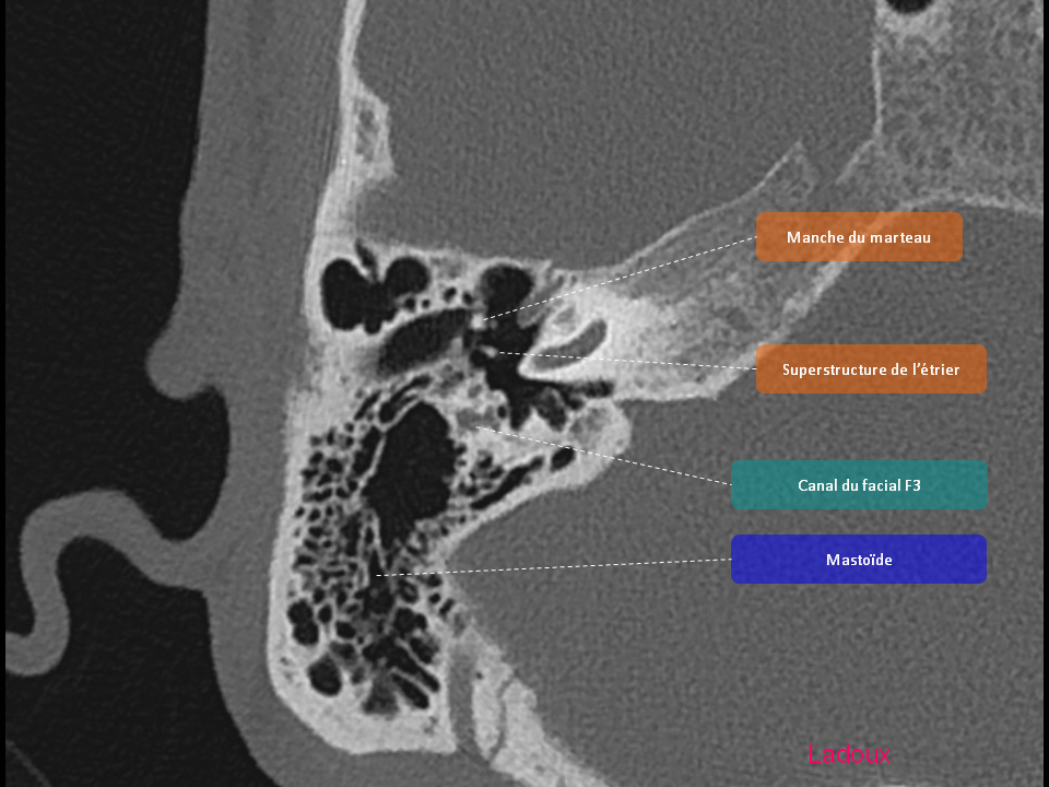 Anatomie du rocher