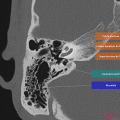 Anatomie du rocher