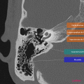 Anatomie du rocher