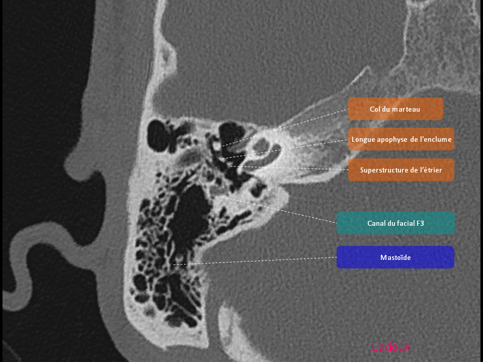 Anatomie du rocher