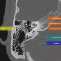 Anatomie du rocher