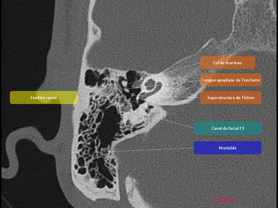 Anatomie du rocher