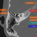 Anatomie du rocher