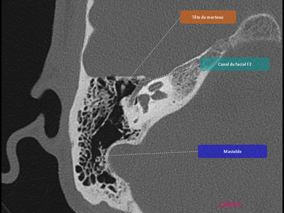 Anatomie du rocher