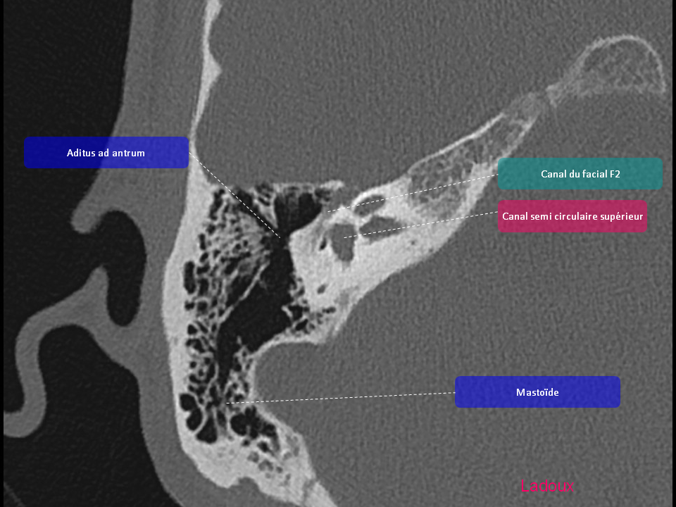 Anatomie du rocher