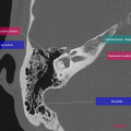 Anatomie du rocher