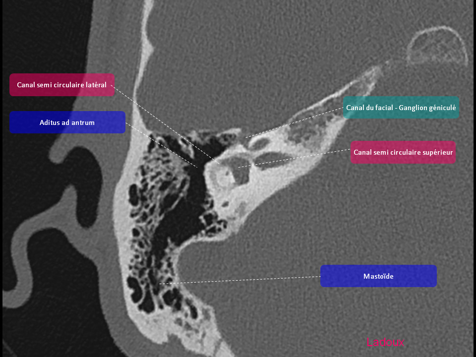 Anatomie du rocher