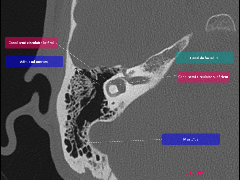 Anatomie du rocher