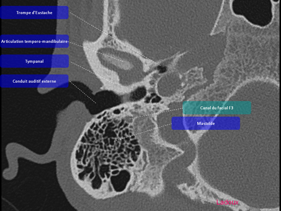 Anatomie du rocher