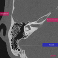 Anatomie du rocher