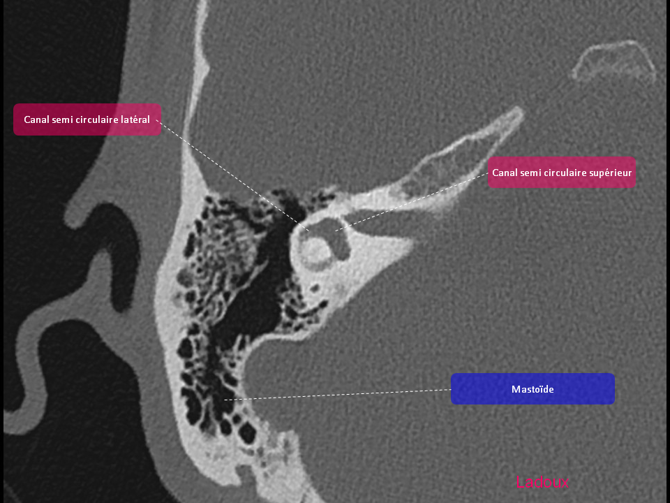 Anatomie du rocher