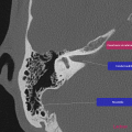 Anatomie du rocher