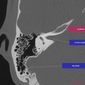 Anatomie du rocher