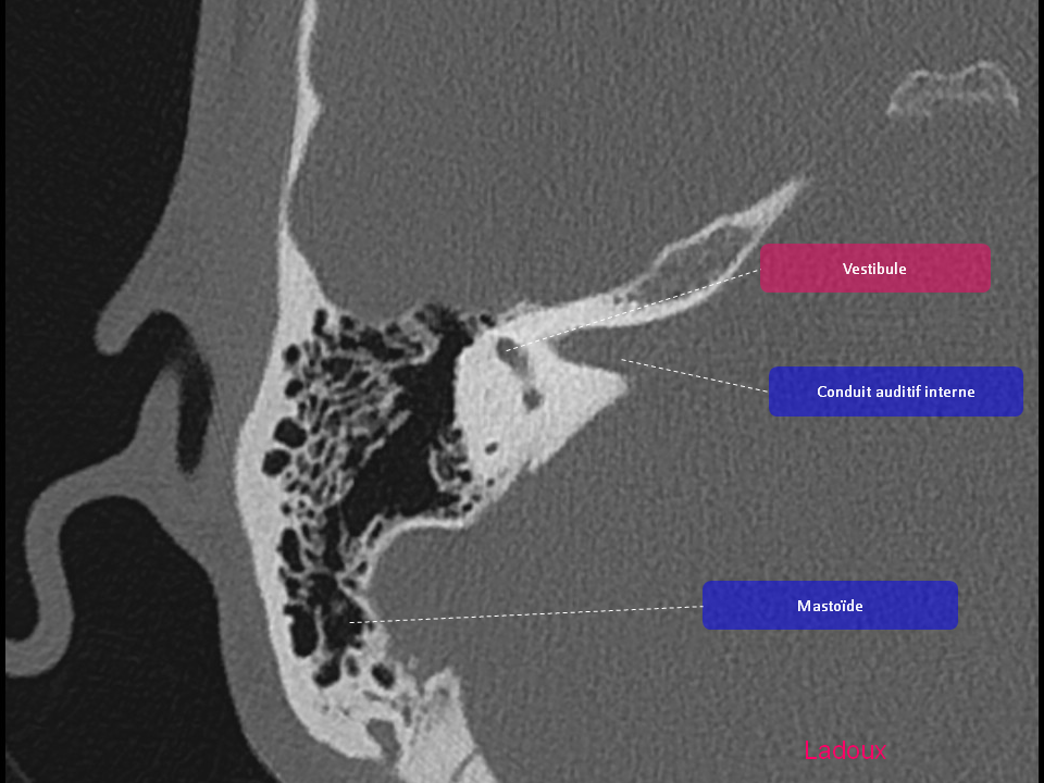 Anatomie du rocher