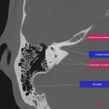 Anatomie du rocher