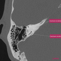 Anatomie du rocher