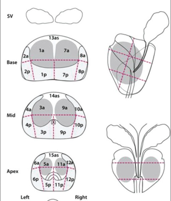 Точка простаты. Схема предстательной железы. Схема предстательной железы Pirads. Сегменты предстательной железы Pi-rads. Зональная анатомия предстательной железы.