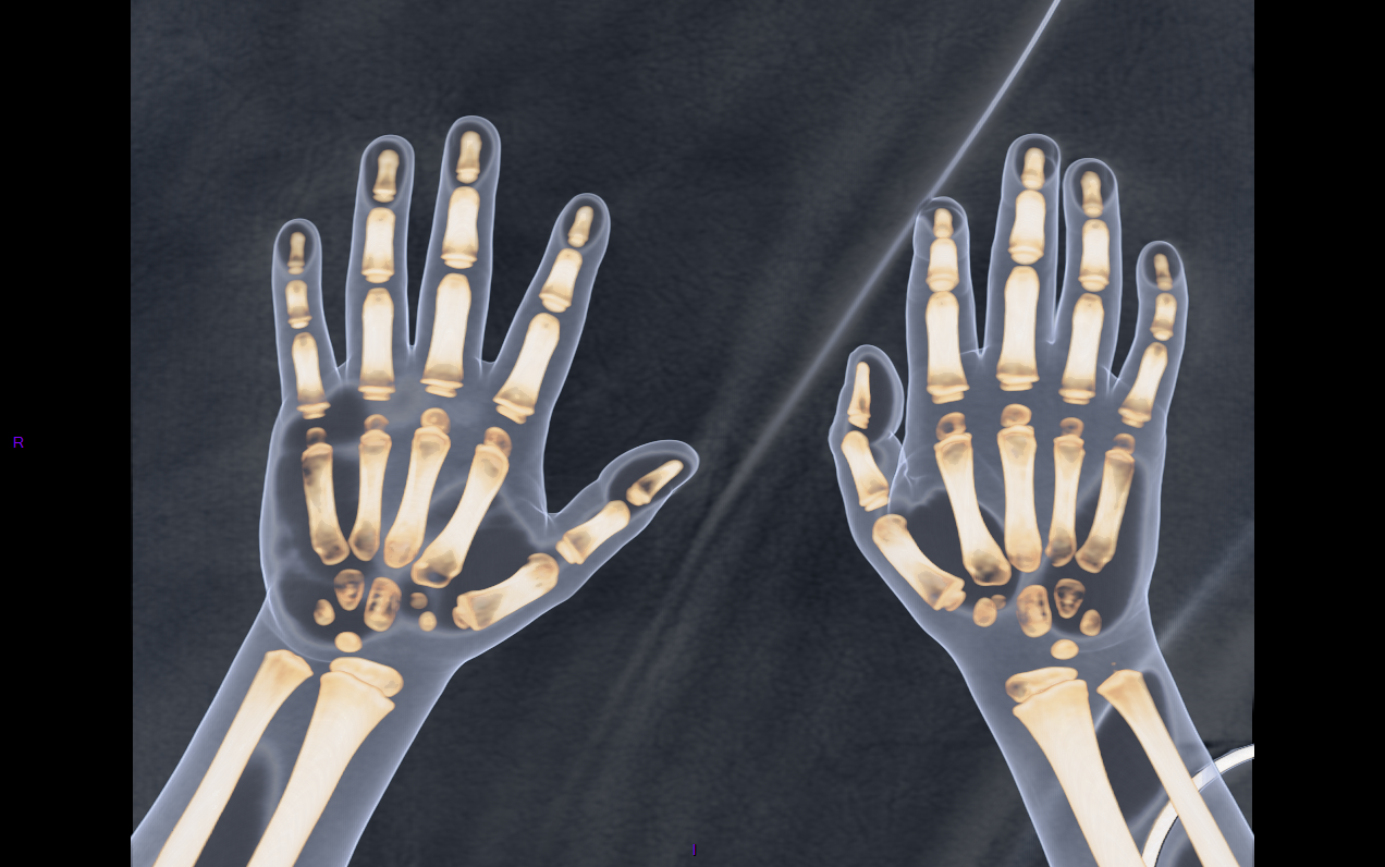 PinkyBone, votre mémo de radiologie partout PinkyBone